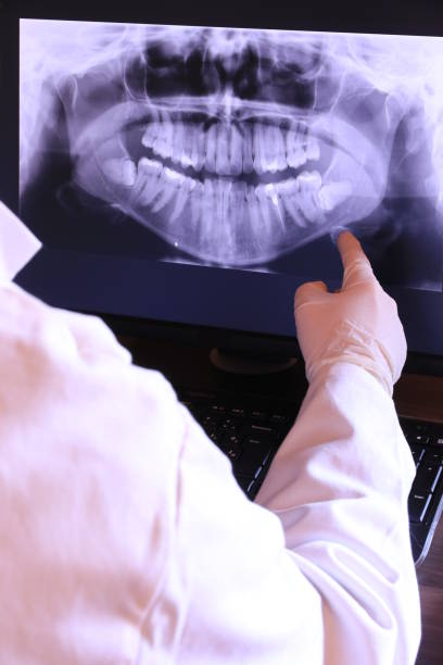 Best Emergency Dental Care for Broken or Chipped Teeth in Trainer, PA
